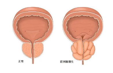 兩性健康 | 對于女性來說，最怕男人得什么??？(圖1)